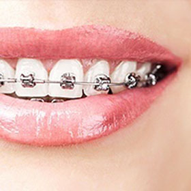 Orthodontic Services